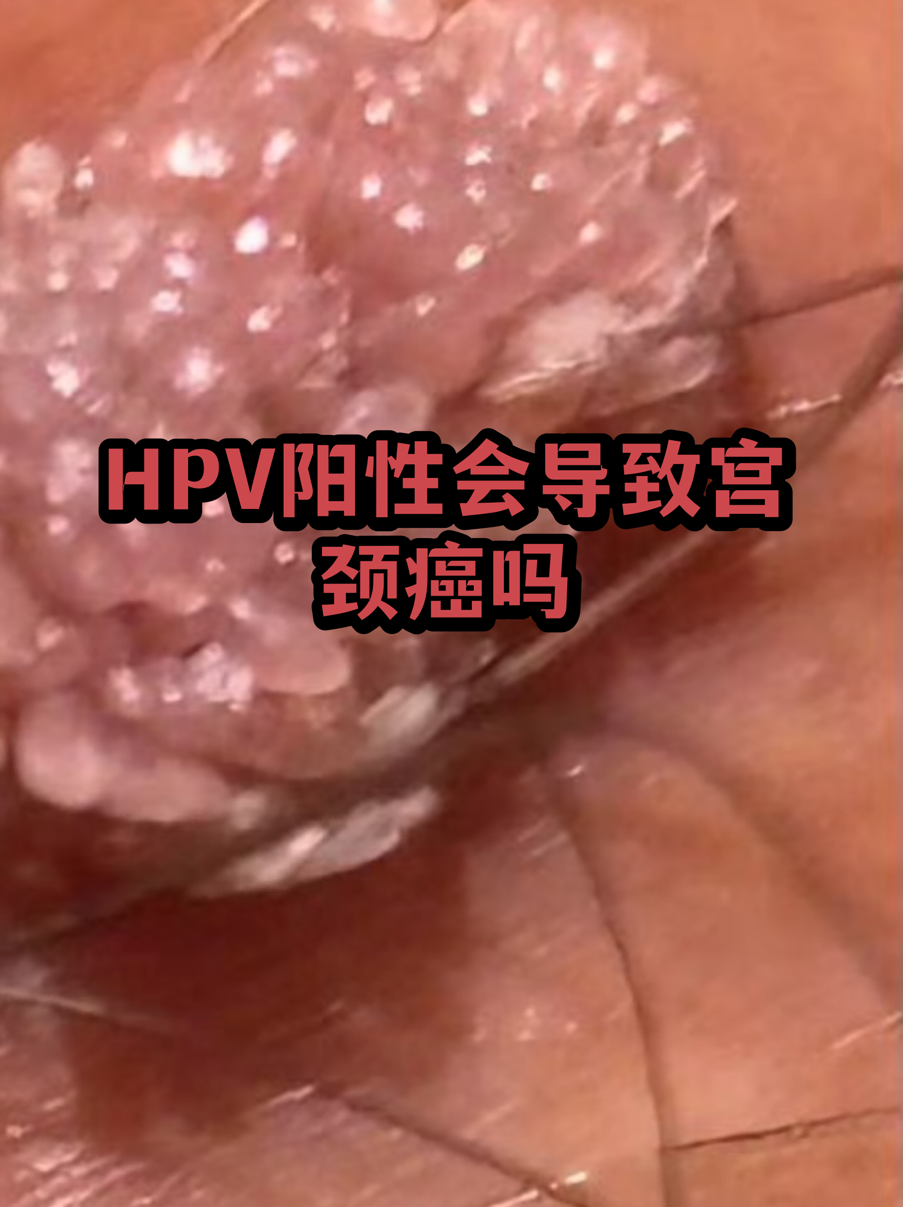“保定:感染者确实不少” 保定3人感染病毒？-第2张图片