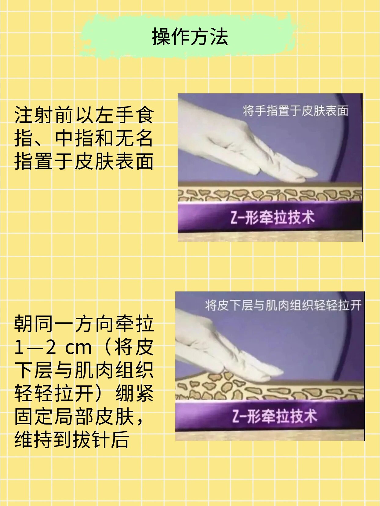 3分钟学会“闲逸碰胡可以开挂吗	”分享装挂详细步骤-第1张图片