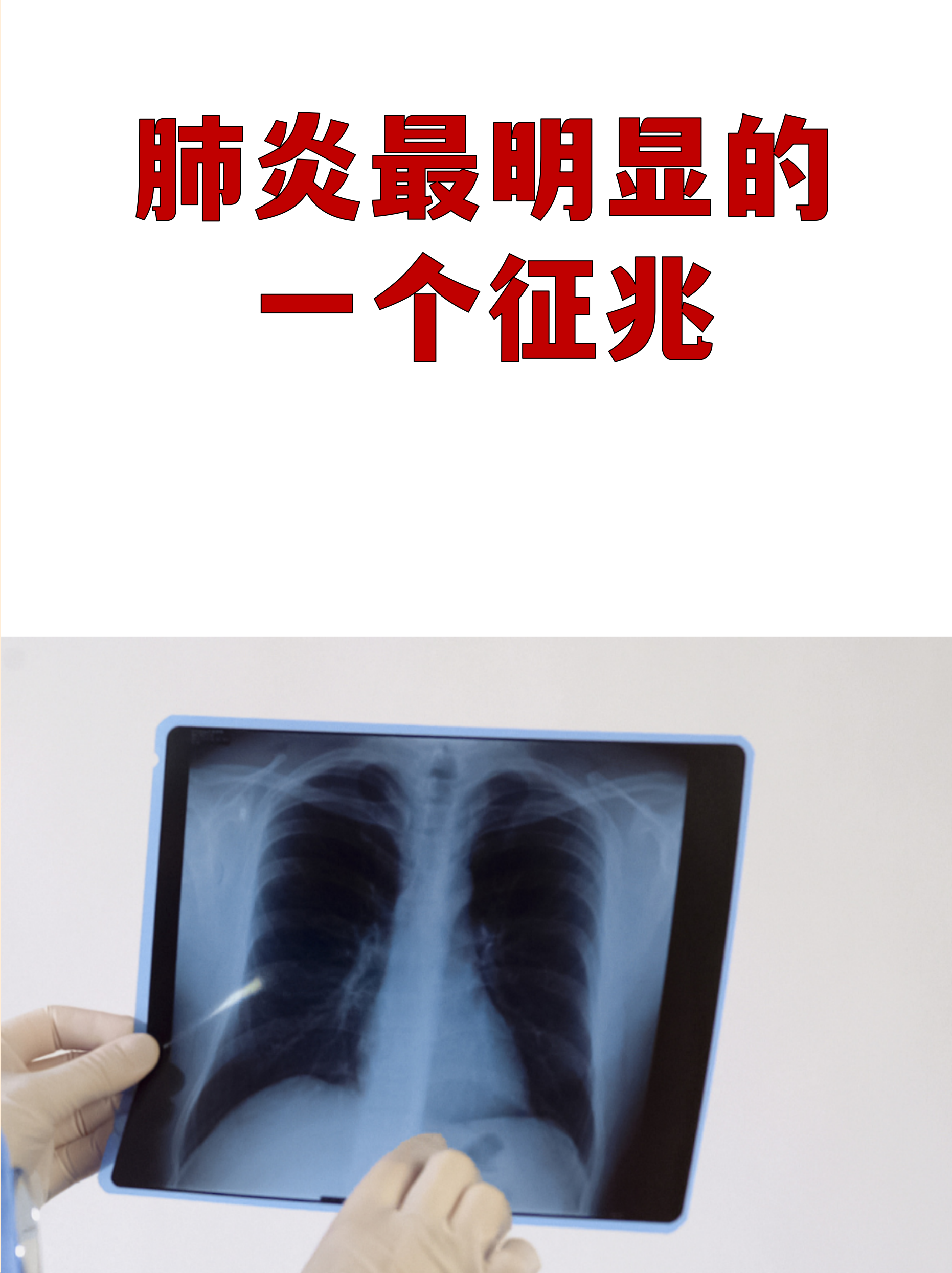 「辽宁沈阳又发现一例吗今天」〃沈阳发现一例肺炎吗-第1张图片