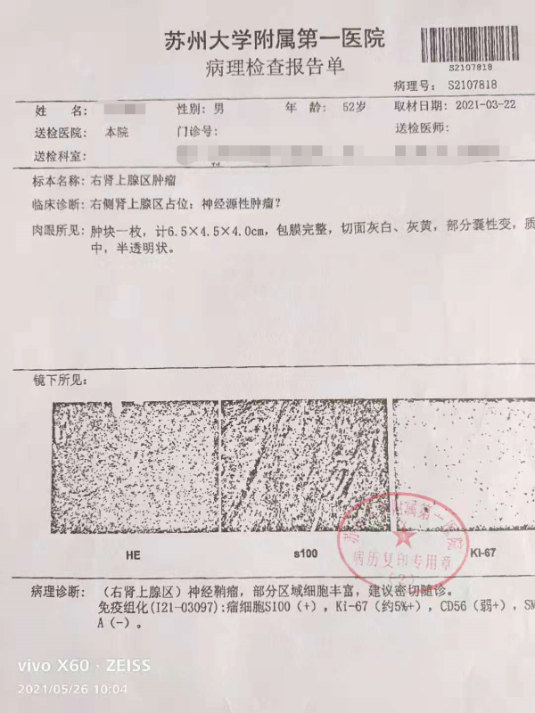 山东最新疫情报告〃山东最新疫情报告今天-第2张图片