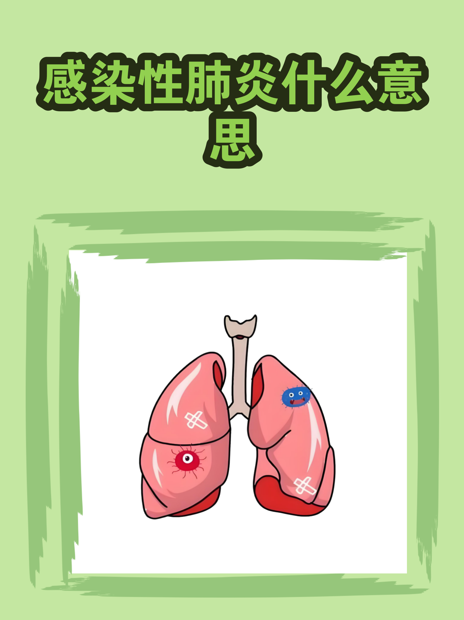 河北肺炎︰(河北肺炎都有啥病毒)