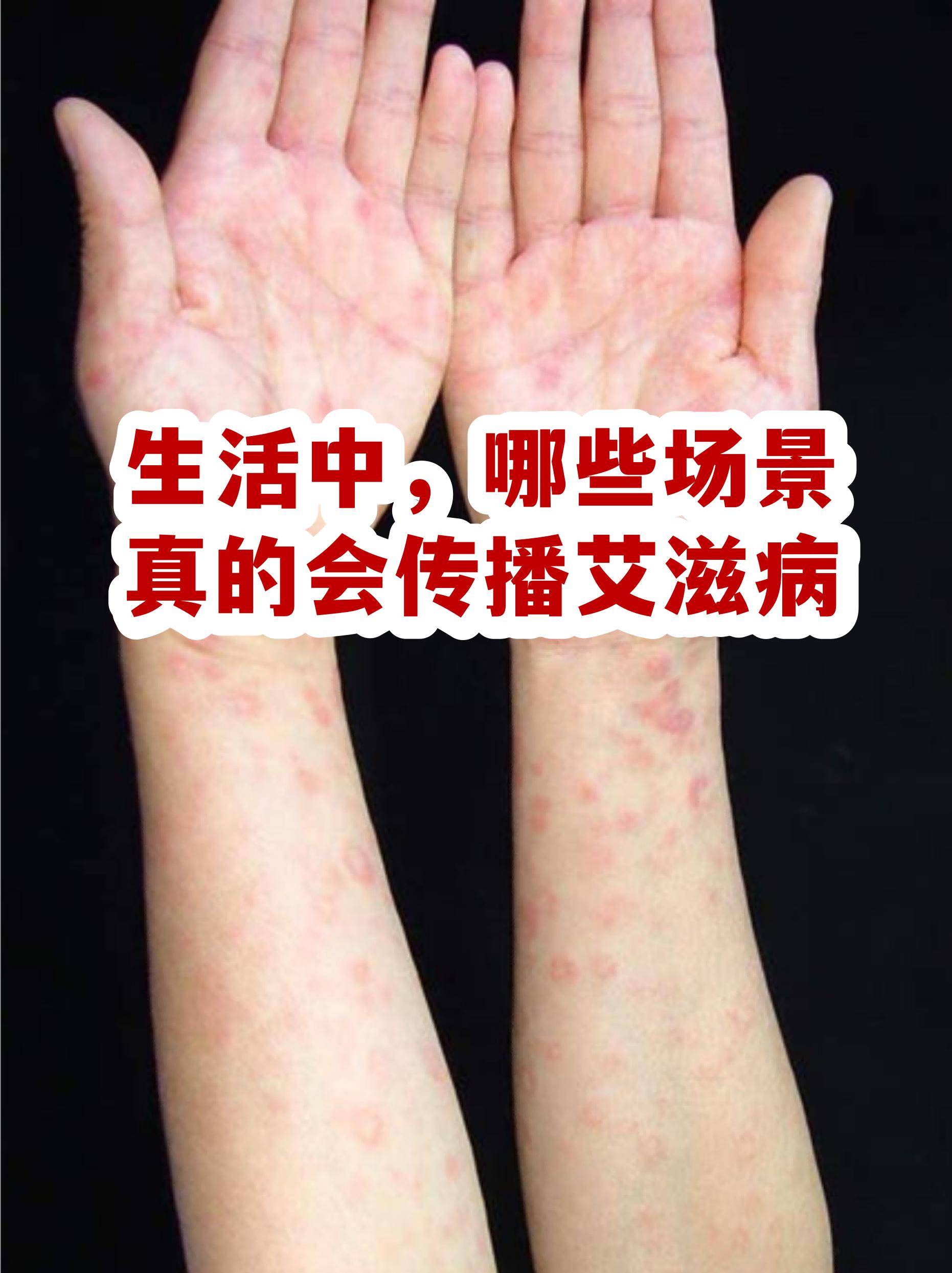 印度:中国感染人数激增印度行业谨慎应对〃印度感染实际人数-第1张图片